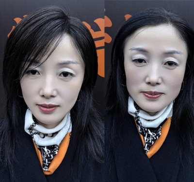 01头顶补发片 高科技记忆发