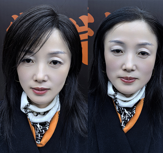 01头顶补发片 高科技记忆发